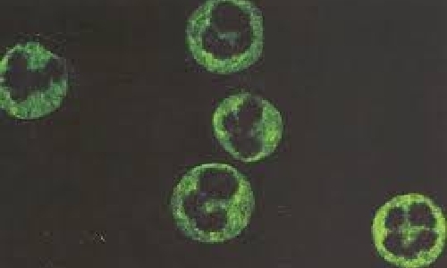 imagen no encontrada