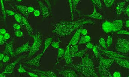 imagen no encontrada